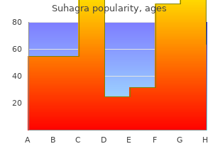 purchase suhagra overnight delivery