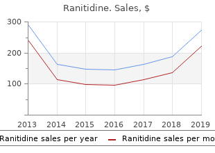 buy 150mg ranitidine overnight delivery