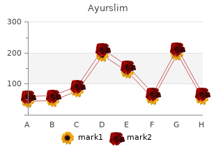 buy ayurslim with amex